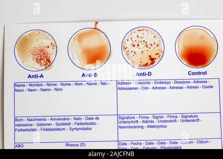 Nahaufnahme Von Home Abo Blutgruppe Test Kit Zeigen Ergebnisse Des