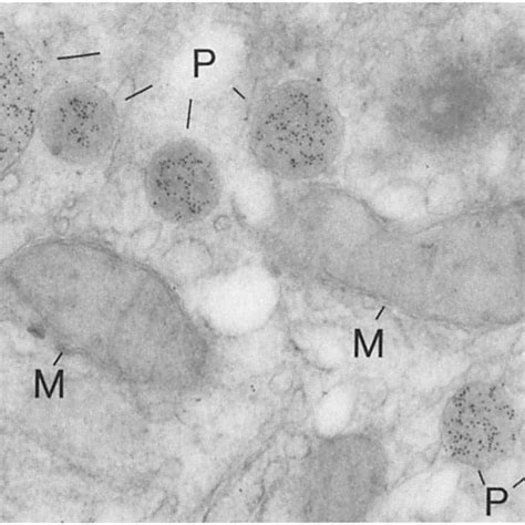 An Electron Micrograph Of An Ultrathin Section Of Normal Rat Liver Download Scientific Diagram