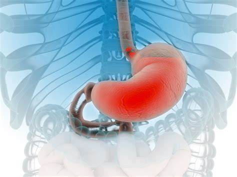 Ern Hrung Mit Reflux Und Sodbrennen Reflux Kliniken