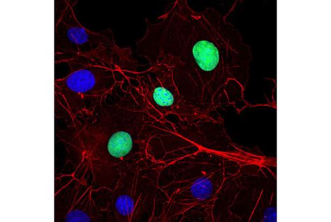 Myc Tag 9B11 Mouse MAb Cell Signaling Technology