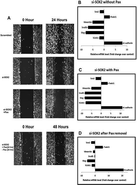 Modulation Of Sox2 Expression Delineates An End Point For Paclitaxel