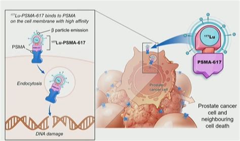 Asco 2022 68ga Ga Psma 11 Pet Baseline Imaging As A Prognostic Tool