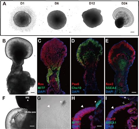 Figure 1 From SCF SCFR Signaling Plays An Important Role In The Early