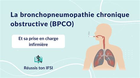 Prise en charge de l infarctus du myocarde Réussis ton IFSI