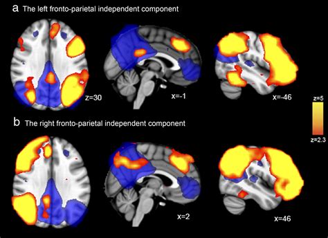 Fractionating The Default Mode Network Distinct Contributions Of The Ventral And Dorsal