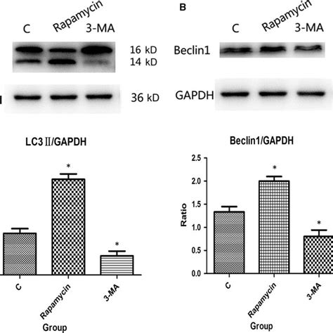 Western Blot Analysis Of LC3II And Beclin1 Expression In IEC6 Cells