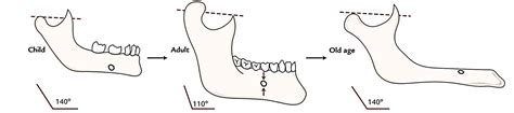 Easy Notes On 【Mandible】Learn in Just 4 Minutes!