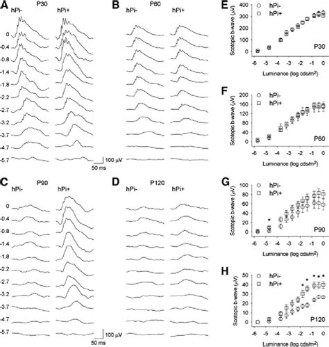 Electroretinographic ERG Responses In Control HPi And Proinsulin