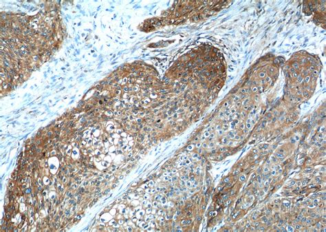 Beta 2 Microglobulin Rabbit Polyclonal Antibody