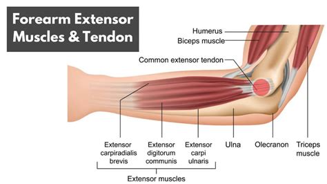 Forearm Tendonitis Symptoms