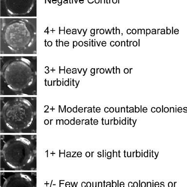 Guidelines For The Interpretation Of Broth Microdilution Results For