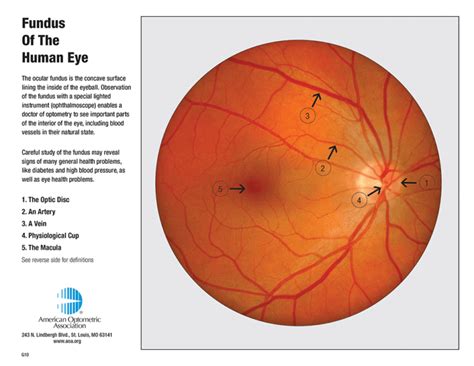 RETINA ANATOMY | Eye Desire Eye Care and Optical Boutique