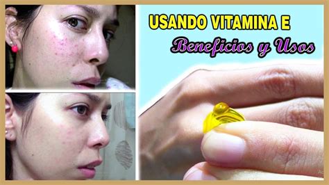 USANDO POR 5 DÍAS VITAMINA E EN EL ROSTRO LO QUE PASÓ ES INCREÍBLE