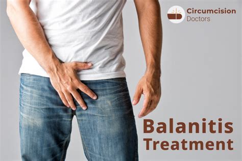 Balanitis Treatment Surgery Procedure Recovery Risks