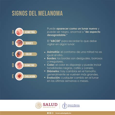 Ins Nal Cancerología on Twitter DíaMundialDelMelanoma Conoces el