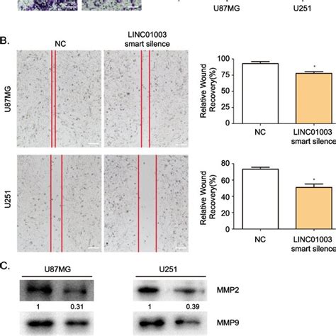 LINC01003 Is Upregulated In Glioma Tissues And Cells A The Expression