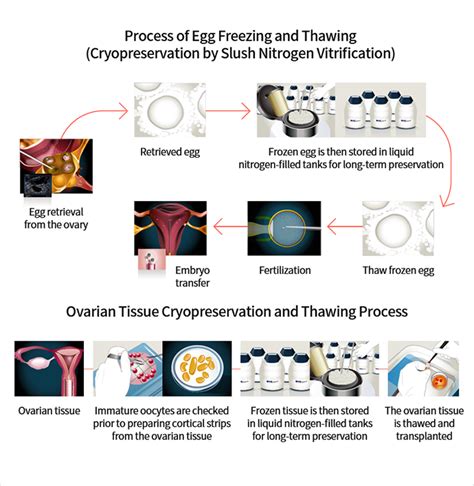 Fertility Preservation Clinic Cha Ilsan Medical Center