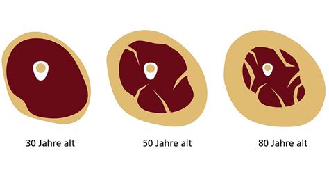 Gesunde Ern Hrung Und Krafttraining Zur Pr Vention Von Sarkopenie