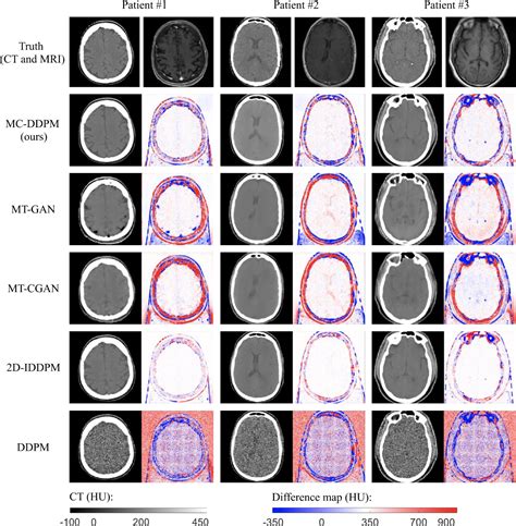 Figure 3 From Synthetic CT Generation From MRI Using 3D Transformer