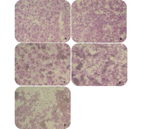 Morphological Changes Of Mcf Treated With Different Concentrations Of