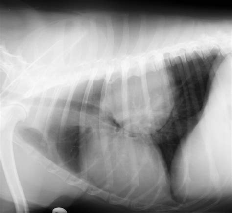 Thoracic Tumors - Lung — DR. JULIUS M. LIPTAK