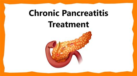 Chronic Pancreatitis Treatment Chronic Pancreatitis