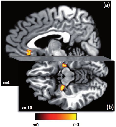 Regions Where Anticipation Of A Primary Reward Is Associated With Trait Download Scientific