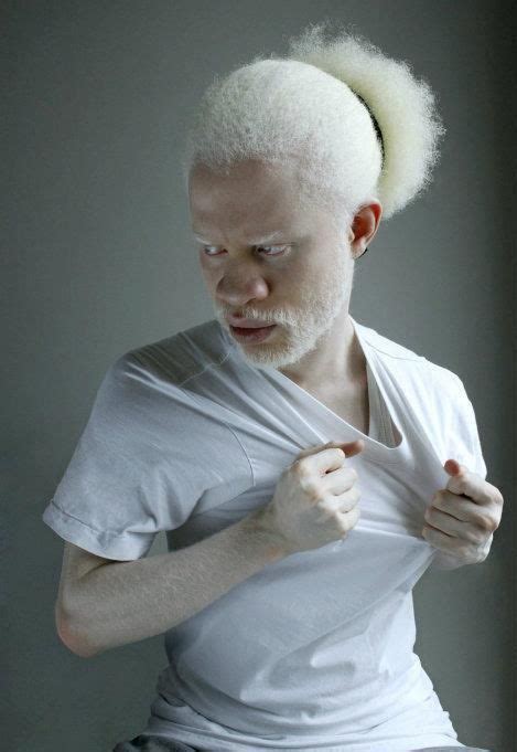 Tausendsassa Albino Men Albino Model Interesting Faces