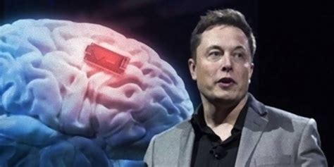 Elon Musk Anunció Que Su Empresa Implantó Por Primera Vez Un Chip Cerebral Inalámbrico En Un Ser