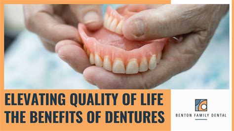 PPT Smile Confidently Again Exploring The Benefits Of Dentures