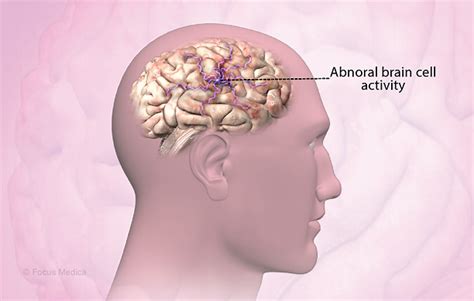 Health Condition : Symptoms, Causes, Treatment and More