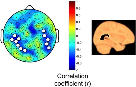 Developing Brain Regions In Children Hardest Hit By Sleep Deprivation