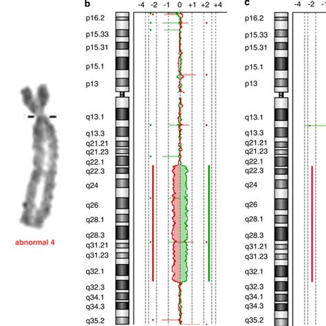 Chromosome 4 microsatellite analyses | Download Table