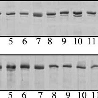 Electrophoretic Separation Of Myosin Heavy Chain Isoforms MyHC I And