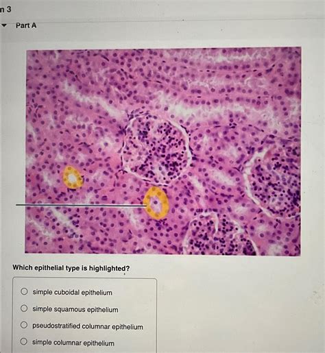which epithelial type is highlighted 4