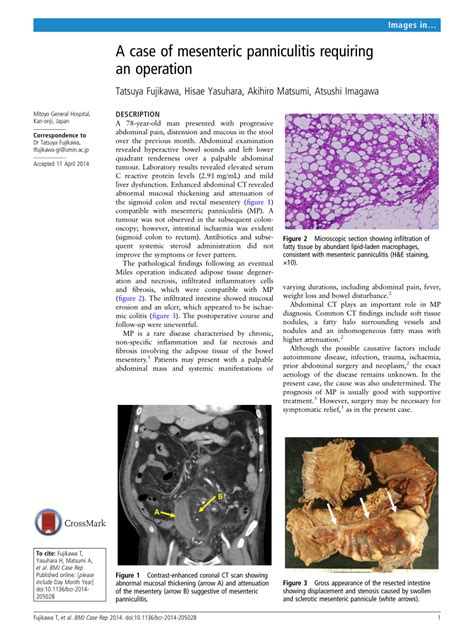 Pdf A Case Of Mesenteric Panniculitis Requiring An Operation