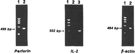 Spontaneous expression of perforin gene by DN T cells from lpr mice ...