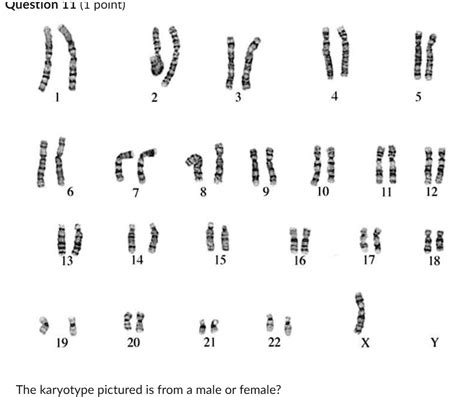 Solved A Male B Female 2 What Is Abnormal About This Karyotype A Missing A Sex Chromosome