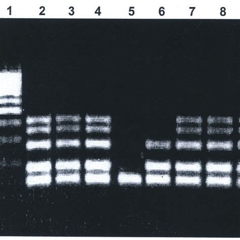 Gel Electrophoresis Results After Mpcr With M For The Amplifi Cation