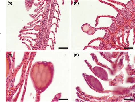 Figure From Epitheliocystis In Three Wild Fish Species In Tasmanian