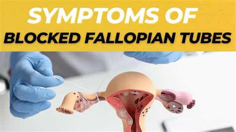 Symptoms Of Blocked Fallopian Tubes And Treatment Options Youtube