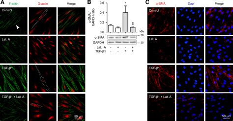 Cooperative signaling by TGF β1 and WNT 11 drives sm α actin expression