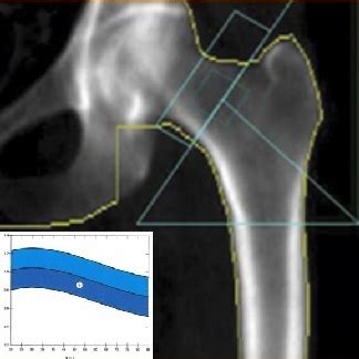 Risonanza Magnetica Articolare E MOC DEXA