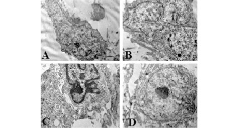 Transmission Electron Microscopy Photomicrographs Revealed Storiform