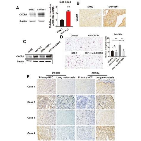 Knockdown Of Prrx Activates Sdf Cxcr Axis Via Upregulating The