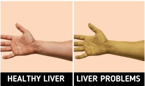 body symptoms    aware