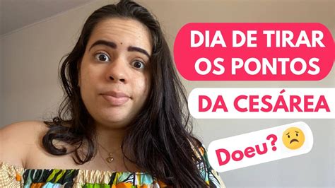 Com Quantos Dias Tira O Ponto Da Cesárea - VLOG DIA DE TIRAR OS PONTOS DA CESAREA | Doeu pra tirar os pontos da ...