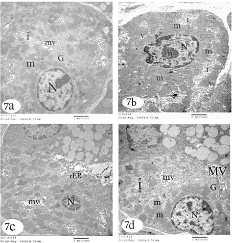 Figure From Effects Of Indomethacin On The Gastric Mucosa Of Adult