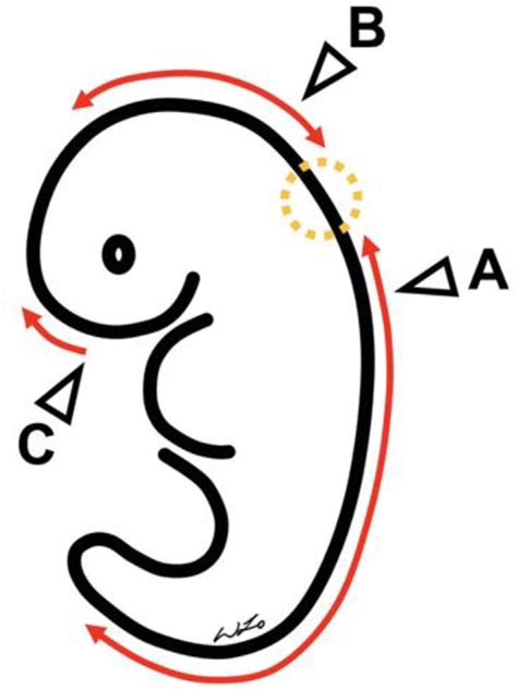 Schematic diagram showing the current model for multi-site neural tube ...