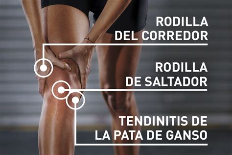 Problemas De Rodilla Los Tipos De Dolor M S Comunes Sanatorio